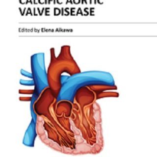 Calcific Aortic Valve Disease by Elena Aikawa