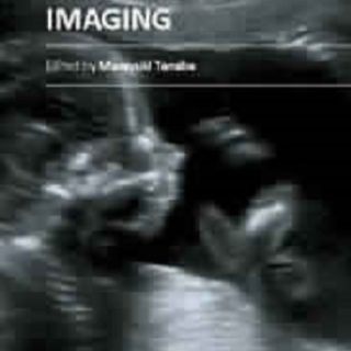Ultrasound Imaging
