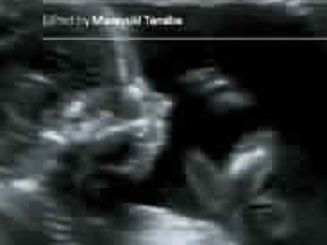 Ultrasound Imaging