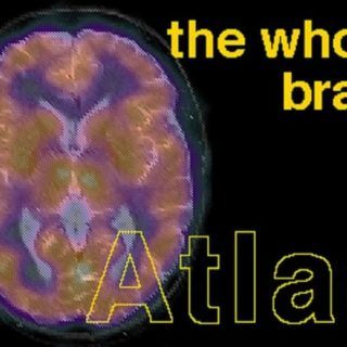 The Whole Brain Atlas by Keith A. Johnson, J. Alex Becker