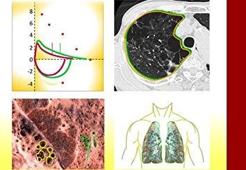 A COPD Primer by Ralph Panos, William Eschenbacher