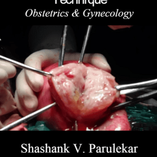 Operation Theater Techniques: Obstetrics and Gynecology  by Shashank V. Parulekar