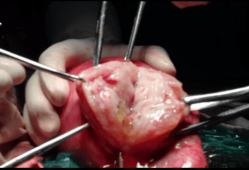 Operation Theater Techniques: Obstetrics and Gynecology  by Shashank V. Parulekar