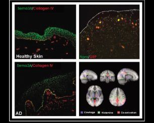 Itch: Mechanisms and Treatment by E Carstens, Tasuku Akiyama (eds) free book