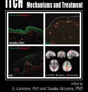 Itch: Mechanisms and Treatment by E Carstens, Tasuku Akiyama (eds) free book