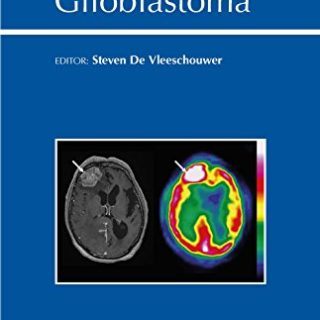 Glioblastoma by Steven De Vleeschouwer (ed.) free book