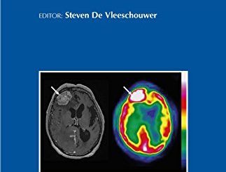 Glioblastoma by Steven De Vleeschouwer (ed.) free book