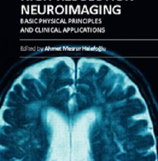 High-Resolution Neuroimaging  by Ahmet Mesrur Halefoglu (ed.) top free books PDF